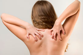 Dermatitis Seborreica